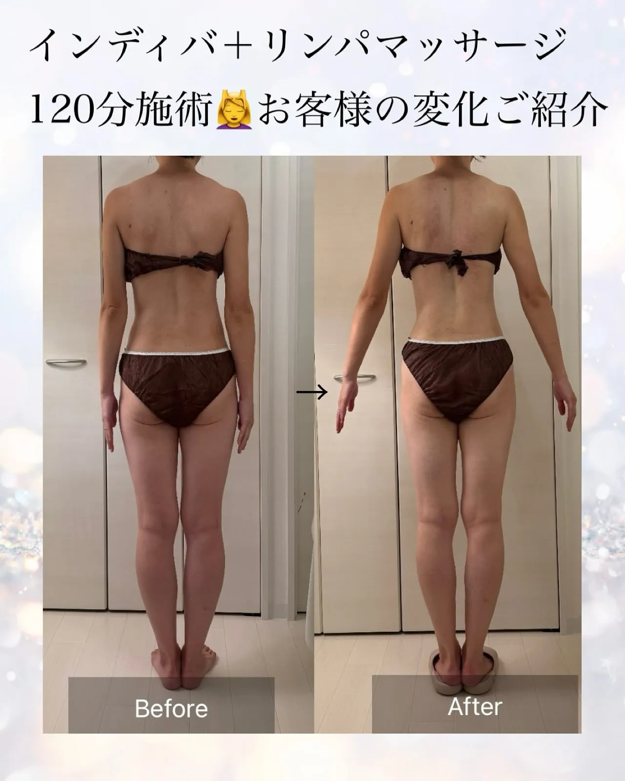 インディバ施術のビフォーアフターをご紹介します✨