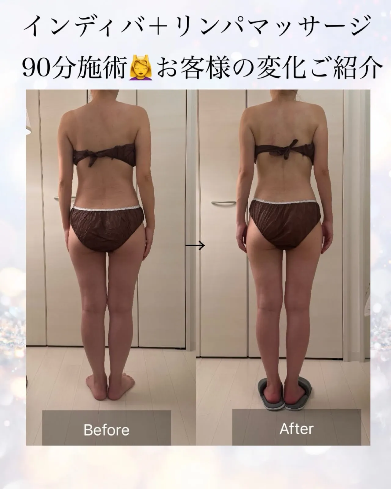 インディバ施術1回の変化です💆♀️✨